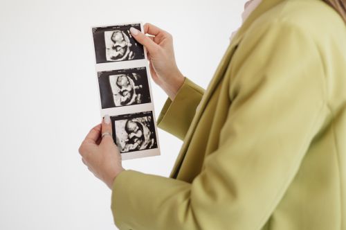 Резус-конфликт