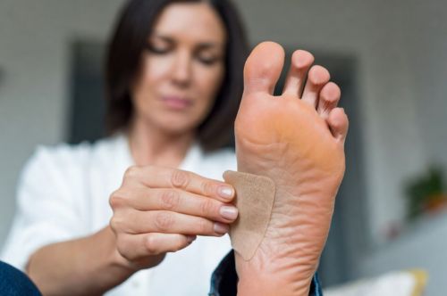 Подошвенная бородавка