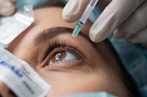 Интравитреальные инъекции теперь доступны по ОМС для жителей Ленобласти