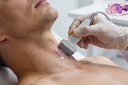 ТАБ (тонко-игольная биопсия) узла щитовидной железы с гистологическим исследованием